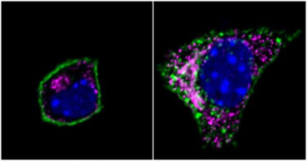 beta cells