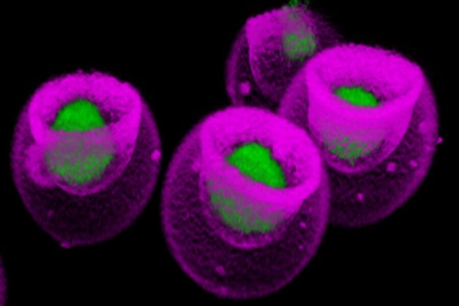 Confocal microscopic image shows mesenchymal stem cells (green) captured within nanovials (pink). The nanovial technology was developed by UCLA's Dino Di Carlo and colleagues.