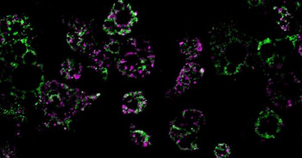 How obesity dismantles our mitochondria