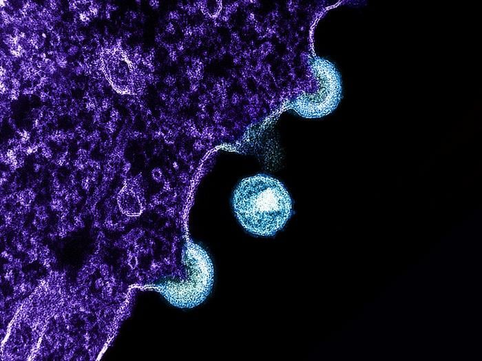 Transmission electron micrograph of HIV-1 virus particles (blue) from infected H9 cells, produced in cell culture. The particles exhibit two stages of replication: the two “arcs” are immature particles budding from the plasma membrane of the cell, and the center spherical particle is a mature form in extracellular space. Image captured at the NIAID Integrated Research Facility in Fort Detrick, Maryland.