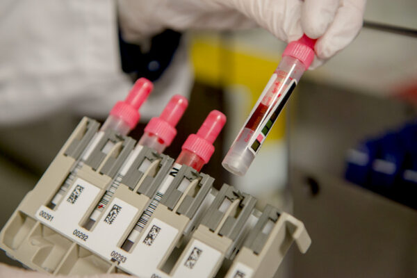 Simple and Reliable Early Prediction of Diabetes