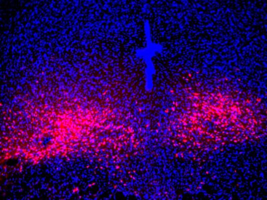 Scientists find brain pathway mediating panic disorder symptoms