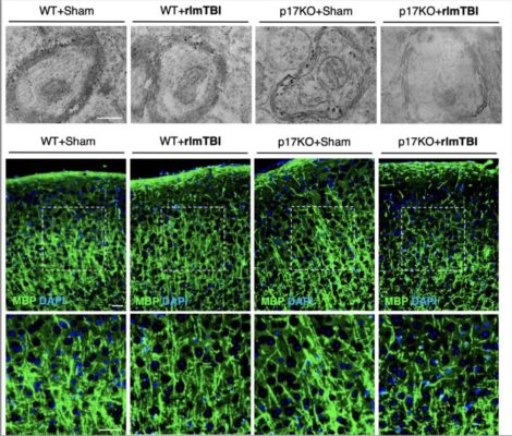 The p17 transporter in mice