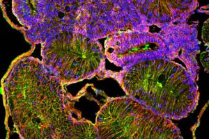 A transverse section through the Xenopus tadpole intersects multiple loops of the rotated intestine.