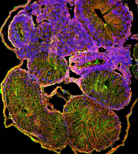 A transverse section through the Xenopus tadpole intersects multiple loops of the rotated intestine.