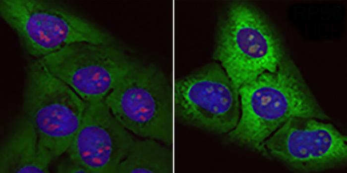  normal cells (left) and cells subjected to the effect of the toxic arginine-rich protein (right). In the latter, ribosomal proteins (green fluorescent) and the size of nucleoli (red) are increased.