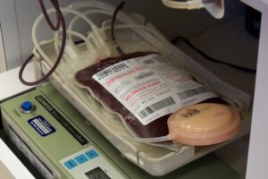 Blood transfusion, which are usually life-saving procedures, can become life-threatening if they trigger an allergic reaction. However, the mechanisms behind allergic transfusion reactions are not well known. This study revealed that such allergic reactions might be related to food allergies, triggered by the presence of relevant allergens in the donated blood based on the food the donor consumed prior to donation.