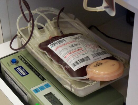 Donor diets can trigger allergic reactions in blood recipients