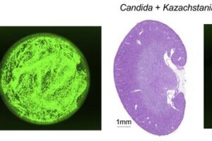 C. albicans spreads to the kidneys of immunosuppressed mice (left), but invasive candidiasis is mitigated by exposure to K. weizmannii (right).