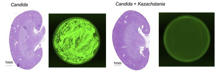 C. albicans spreads to the kidneys of immunosuppressed mice (left), but invasive candidiasis is mitigated by exposure to K. weizmannii (right).