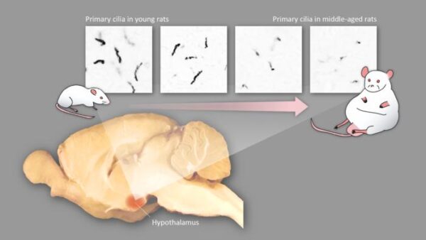 Shortening of MC4R+ primary cilia in the hypothalamus of the brain leads to middle-age obesit...                    </div>

                    <div class=