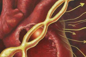 An illustration that depicts the link between the Y chromosome and heart health in men.