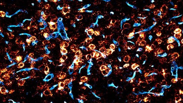 Credit: Deverman lab Brain vasculature (in blue) surrounded by RNA (in orange) transcribed from the gene delivered to the brain in humanized mice using an engineered AAV targeting the human transferrin receptor.