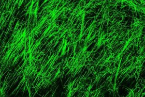 Inhibition of an ESI1 target promotes oligodendrocyte myelin production in mice, as shown as a dense curtain of green strands. This small molecule shows early promise as a potential treatment for MS, and to manage aging-related nerve sheath deterioration, according to study led by experts at Cincinnati Children's.
