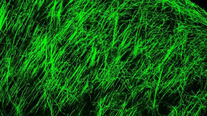 Inhibition of an ESI1 target promotes oligodendrocyte myelin production in mice, as shown as a dense curtain of green strands. This small molecule shows early promise as a potential treatment for MS, and to manage aging-related nerve sheath deterioration, according to study led by experts at Cincinnati Children's.