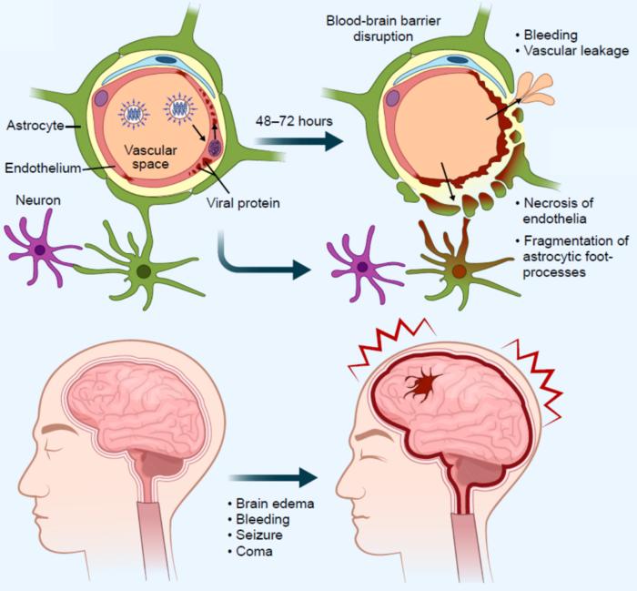 The IAE pathogenesis, with severe brain edema caused by IAV, could be established without viral proliferation: Influenza virus protein was produced and accumulated in the influenza virus-infected endothelial cells (EC). Without producing daughter virus, accumulated viral protein induced necrosis of EC and disruption of blood-brain barrier leading to vascular leakage and bleeding.
