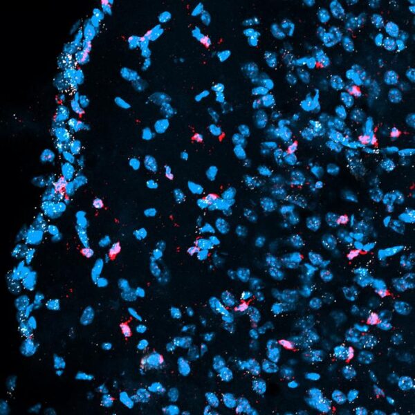 A section of a mouse juvenile brain (cerebral cortex) showing cell nuclei (blue), microglia (red) and the activation of a specific gene called Hes1 (white).