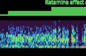 A spectrogram of brain rhythm frequencies over time predicted by the team's model. After a first, moderate dose of ketamine gamma brain rhythm power (warmer colors) emerges. Then as the dose increases, the gamma rhythms become periodically interrupted, leaving only very low freqeuncy waves, and then resume.