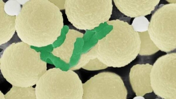 To clean water, researchers have designed swarms of tiny, spherical robots (light yellow) that collect bacteria (green) and small pieces of plastic (gray).