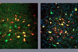 VGAT cells in the periaqueductal gray, stained green and yellow. The cells stained red make synaptic contacts in VGAT neurons (images: researchers’ archive)