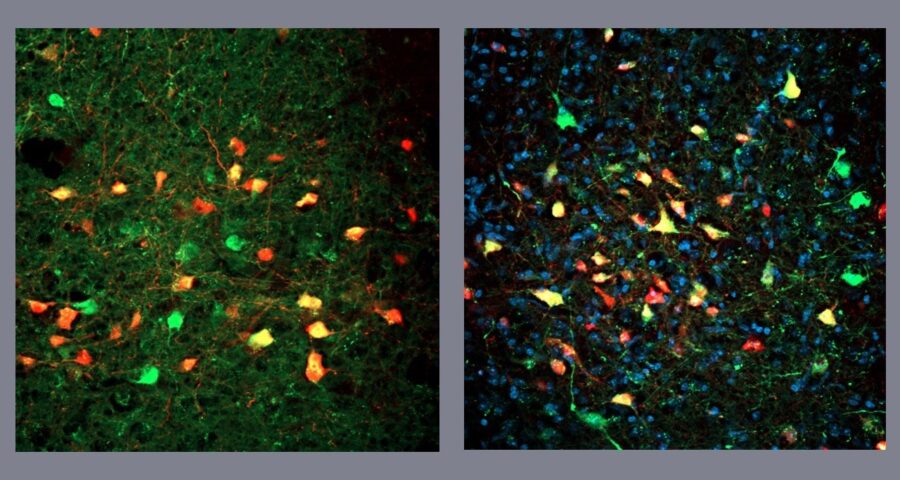 VGAT cells in the periaqueductal gray, stained green and yellow. The cells stained red make synaptic contacts in VGAT neurons (images: researchers’ archive)