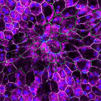 Front cover from June’s Science Translational Medicine showing rescued retinal pigment epithelium (RPE) cells following IRAK-M gene therapy