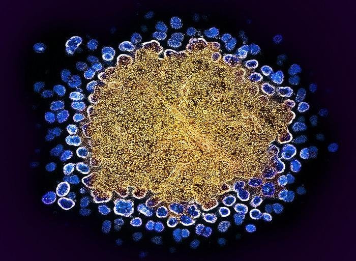 Colorized transmission electron micrograph of numerous HIV-1 virus particles (blue) replicating from a segment of a chronically infected H9 T cell (gold). Image captured at the NIAID Integrated Research Facility (IRF) in Fort Detrick, Maryland.