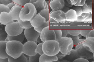 A scanning electron microscopy image of Staphylococcus aureus after treatment with 25 mg/mL of serrawettin W2-FL10 for one hour. A magnification (500 nm) of damaged S. aureus cells is indicated in the red block.