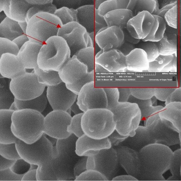 A scanning electron microscopy image of Staphylococcus aureus after treatment with 25 mg/mL of serrawettin W2-FL10 for one hour. A magnification (500 nm) of damaged S. aureus cells is indicated in the red block.