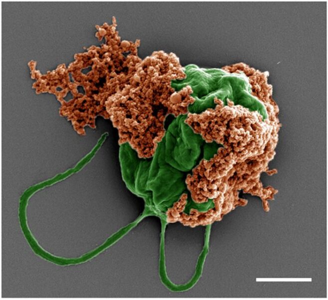 Colored SEM image of a microrobot made of an algae cell (green) covered with drug-filled nanoparticles (orange) coated with red blood cell membranes. Scale bar: 2 µm.