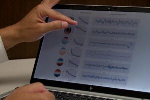 A computer screen shows results from an electroencephalogram, or EEG test.