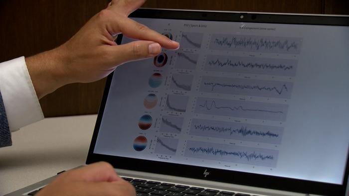 A computer screen shows results from an electroencephalogram, or EEG test.