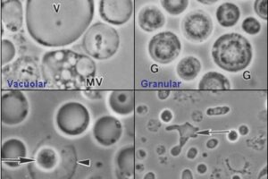 Image shows four common forms of Blastocystis hominis - vacuolar, granular, amoeboid, and cyst forms. Image created by Valentia Lim Zhining on May 14th, 2006.