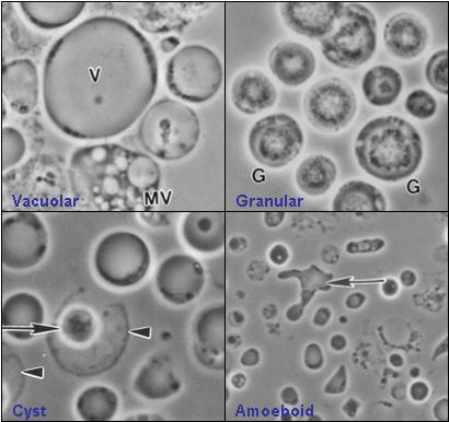 Image shows four common forms of Blastocystis hominis - vacuolar, granular, amoeboid, and cyst forms. Image created by Valentia Lim Zhining on May 14th, 2006.