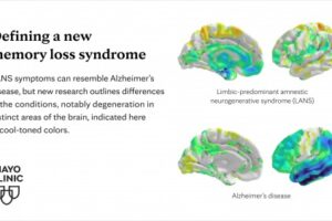 infographic on new memory loss condition