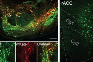 This image shows that the cells in yellow in the pons (left) receive input from the green cells in the cingulate cortex (rACC, right), with subdivisions Cg1 and Cg2.