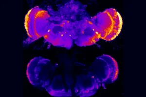 Mutations in the presenilin gene, PSEN1, causes early onset of Alzheimer’s disease in humans and in fruit flies modified to have this gene. A new study led by researchers at Penn State revels that disrupting heparan sulfate–modified proteins in fruit flies suppressed neuronal death and corrected other cell deficits common in early stages of Alzheimer’s and other neurodegenerative diseases. Pictured here are full fruit fly brains, stained with a marker that indicates cell death—brighter colors indicate higher presence of cell death. Top: A fly with deficits in the presenilin gene—a model for Alzheimer’s disease—with high levels of cell death. Bottom: A fly rescued by disrupting heparan sulfate–modified proteins.