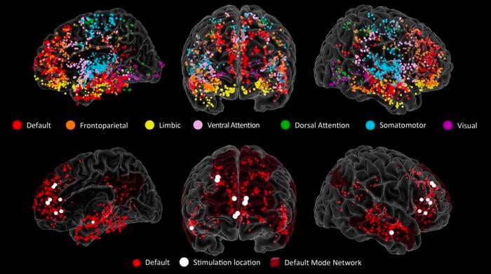 Electrodes at multiple brain regions reveal brain activity in real time. Colored dots show the locations of all of the electrodes across all patients, color-coded by brain region. Red dots in the lower images show the locations of the electrodes in the DMN.