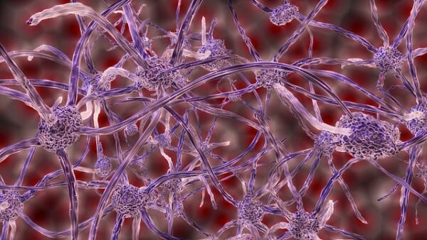 Brain cell grafts in monkeys jump-start human trial for new Parkinson’s treatment