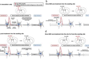 Japanese researchers studied the effects of locally administered ASOs on mouse models of Parkinson's disease. Their research indicates that ASOs can help prevent the formation and spread of harmful alpha-synuclein aggregates in different brain regions, suggesting ASOs as a potential therapeutic strategy for preventing and controlling the progression of neurodegenerative diseases.