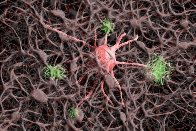 neurons associated with alzheimer's
