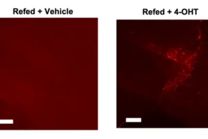 The parasubthalamic neurons sensitive to binge eating, shown in red, reduce the eagerness of mice to start eating.