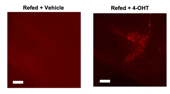 The parasubthalamic neurons sensitive to binge eating, shown in red, reduce the eagerness of mice to start eating.