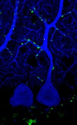 An expansion microscopy image showing synaptic boutons (green) of climbing fibers on a Purkinje cell (blue) from the cerebellum of a mouse.