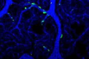 An expansion microscopy image showing synaptic boutons (green) of climbing fibers on a Purkinje cell (blue) from the cerebellum of a mouse.