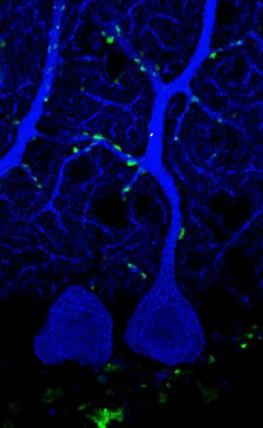 An expansion microscopy image showing synaptic boutons (green) of climbing fibers on a Purkinje cell (blue) from the cerebellum of a mouse.