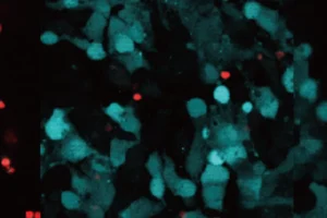 Pictured above: Live (blue) and dead (red) neurons without (left) or with (right) treatment with LK-2, showing that the molecule reduces cell death.