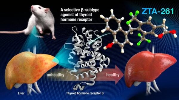 ZTA-261, a highly selective and less toxic THRβ agonist, is a promising candidate to improve lipid metabolism.