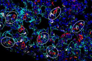 Following infection, in areas of the lung undergoing repair, atypical macrophages (in orange) are located close to type 2 alveolar cells (in white).