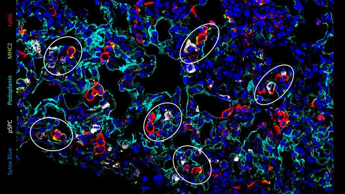 Following infection, in areas of the lung undergoing repair, atypical macrophages (in orange) are located close to type 2 alveolar cells (in white).